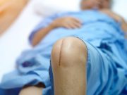 Robotic-Assisted Total Knee Arthroplasty Has Fewer Complications