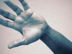 Video-Only Noninferior to In-Person Therapy After Thumb Carpometacarpal Arthroplasty