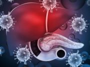 Chronic Hepatitis B Virus Is Undertreated