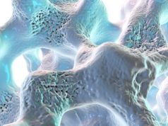 Osteoporosis Screening Rates Low for Asian American Medicare Beneficiaries