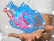 Guidelines Developed for Management of Hypertrophic Cardiomyopathy