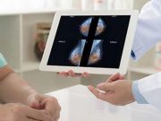 Large Language Models Fall Short in Breast Imaging Classification
