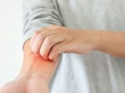 Coexistence of Psoriatic Arthritis, Atopic Dermatitis May Offer Treatment Insights