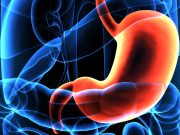 Gastrectomy for Gastric Cancer Tied to Lower Risk for Cardiovascular Events