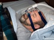 Bariatric Surgery Tied to Lower Risk of MACE, Death in Obesity, Sleep Apnea
