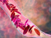 Longer Transfer Gap to Adult Care Increases Inpatient Encounters in Sickle Cell Disease