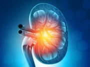 HTN, Albuminuria Risks No Worse for Kidney Donors Versus Nondonors