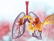 ASCO: Osimertinib Improves Progression-Free Survival in EGFR-Mutated Lung Cancer