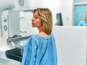 Patient Characteristics Linked to Performance of AI Algorithm for DBT