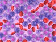 Posttransplant Cyclophosphamide GVHD Prophylaxis Beneficial in Leukemia