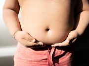 One in Five Children Globally Has Excess Weight