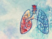 Lung Cancer Screening Increases Earlier-Stage Diagnoses, Improves Survival