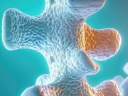 Recommendations Issued for Palliative RT for Symptomatic Bone Mets