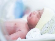 Transcatheter PDA Closure Increasingly Used for Very Low Birth-Weight Infants