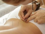 Acupuncture May Relieve Pain-Specific Disability in Degenerative Lumbar Stenosis
