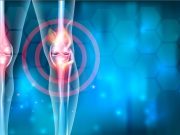 Methotrexate Beneficial for Reducing Pain, Stiffness in Knee Osteoarthritis