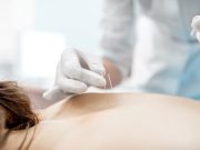 Acupuncture Can Reduce Methadone Dose, Opioid Craving