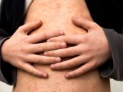 U.S. Measles Cases Are Already Triple Those of Last Year