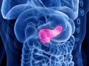 AI-Assisted Model Improves Diagnosis of Solid Lesions in Pancreas