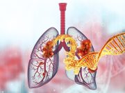 Amivantamab-Lazertinib Ups Survival in EGFR-Mutated Advanced Lung Cancer