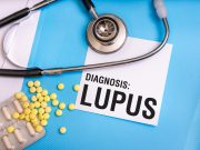 Scientists Spot Cause of Lupus, Way to Reverse It