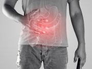 Risankizumab Noninferior, Superior to Ustekinumab for Crohn Disease