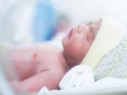 Long-Term Outcomes Similar for Cord Clamping, Umbilical Cord Milking