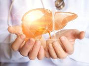 Outcomes Similar for Neoadjuvant ICI-Based Therapy, Upfront Surgery for Liver Cancer