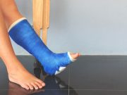 Fracture Risk Higher in Women With T2DM Due to Poorer Physical Function