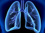 Alternative Criteria Can ID High-Benefit Groups for Lung Cancer Screening