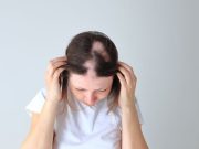 Alopecia Tied to Higher Prevalence of Autoimmune, Psychiatric Comorbidities