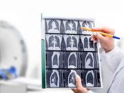 Most Americans Don’t Know About Lung Cancer Screening: Survey
