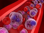 FDA Approves Darzalex Faspro for Treating Multiple Myeloma