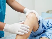 Study Quantifies COVID-19-Linked Deficit in Arthroplasties in the U.K.