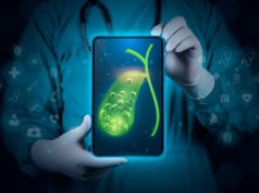 EUS-RV, Precut Sphincterotomy Similar for Salvage for Benign Biliary Disease