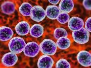 Risk for Second Primary Cancer May Be
No Higher With CAR T-Cell Versus Standard of Care