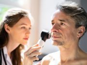 Melanoma Risk Increased After Radioactive Iodine Treatment for Primary Thyroid Cancer