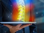 UBE Microdiscectomy Beneficial for Lumbar Disc Herniation