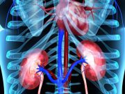 Empagliflozin Confers Kidney-Protective Benefits After Acute MI