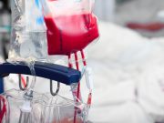Study Looks at Efficacy of Hemoglobin Thresholds for Transfusion