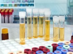 Urine Drug Test Concentrations Up for Fentanyl, Methamphetamine, Cocaine