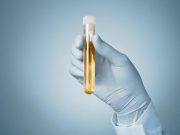 ASN: Atrasentan Significantly and Clinically Meaningfully Cuts Proteinuria