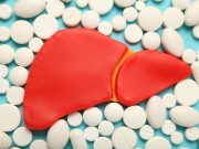 Combo Treatment With Xalnesiran Shows Promise in Patients With Hep B