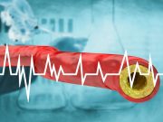 Lower Levels of Total Cholesterol Seen in More Recent Birth Cohorts