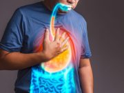 Endoscopic Full-Thickness Plication Efficacious for GERD