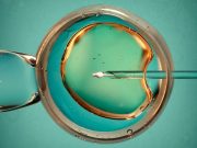 AI Techniques ID Optimal Follicle Size, Could Optimize IVF Treatment