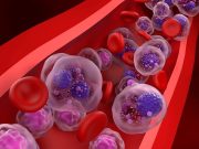 Lower Dexamethasone Dose Does Not Impair Survival in Multiple Myeloma