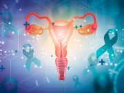Opportunistic Salpingectomy During Any Abdominal Surgery Reduces Ovarian Cancer Risk