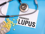 Pericarditis Recurrence Occurs in About 20 Percent of Patients With Lupus
