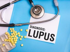 Pericarditis Recurrence Occurs in About 20 Percent of Patients With Lupus